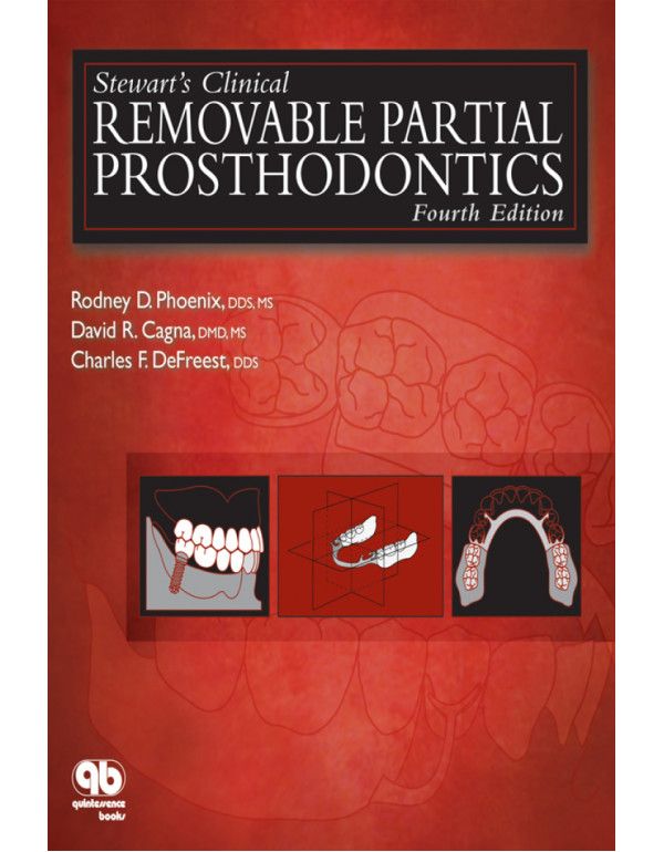 Stewart's Clinical Removable Partial Prosthodontic...