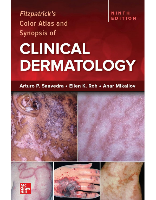 Fitzpatrick's Color Atlas and Synopsis of Clinical...