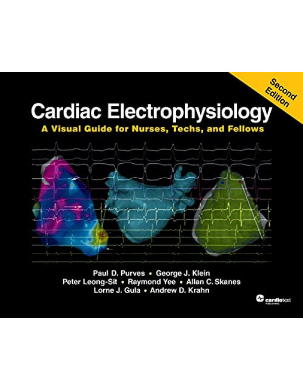 Cardiac Electrophysiology: A Visual Guide for Nurs...