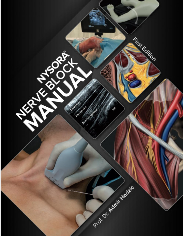 NYSORA Nerve Block Manual: First Edition by Admir ...