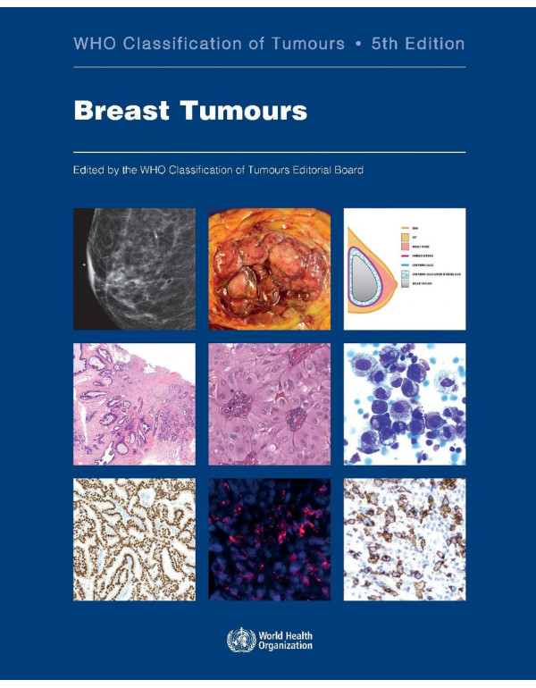 Breast Tumours: WHO Classification Of Tumours, 5th...